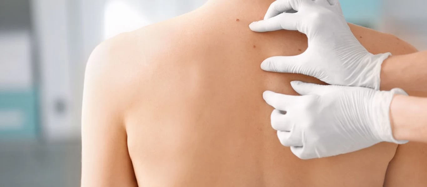 Γιατί το δέρμα μας είναι ευερέθιστο; - Ποια αιτία υπάρχει πίσω από αυτό;